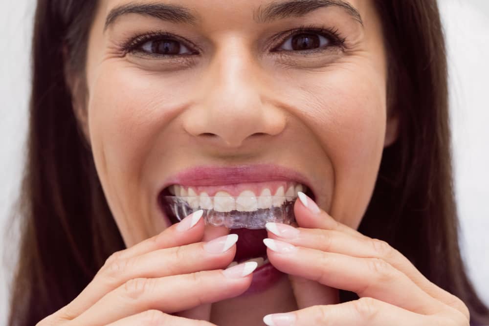 Can Invisalign Fix My Smile? Common Problems Solved