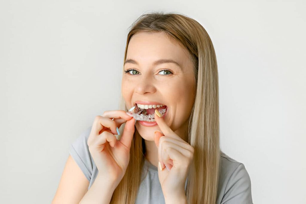 Is it Worth Spending Money On Invisalign?