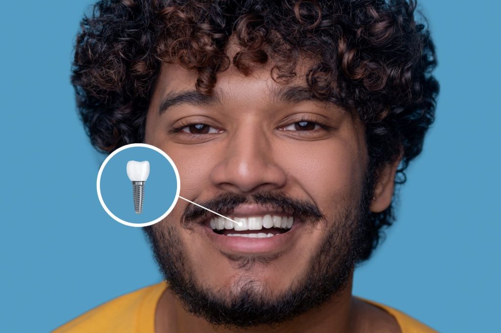 10 Life-Changing Benefits of Getting Dental Implants in 2026