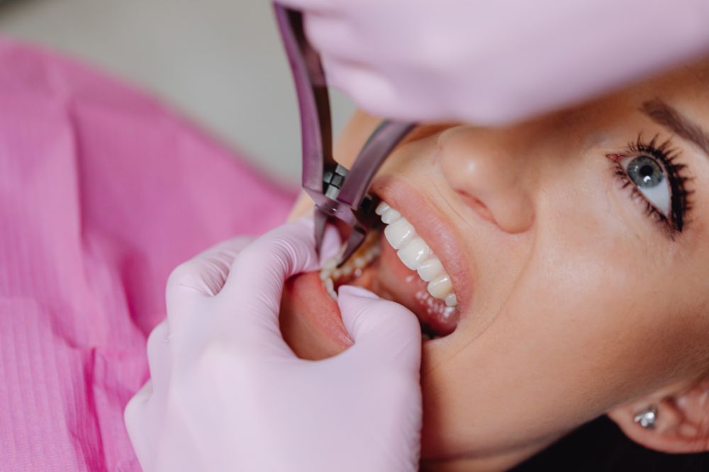 tooth extraction process
